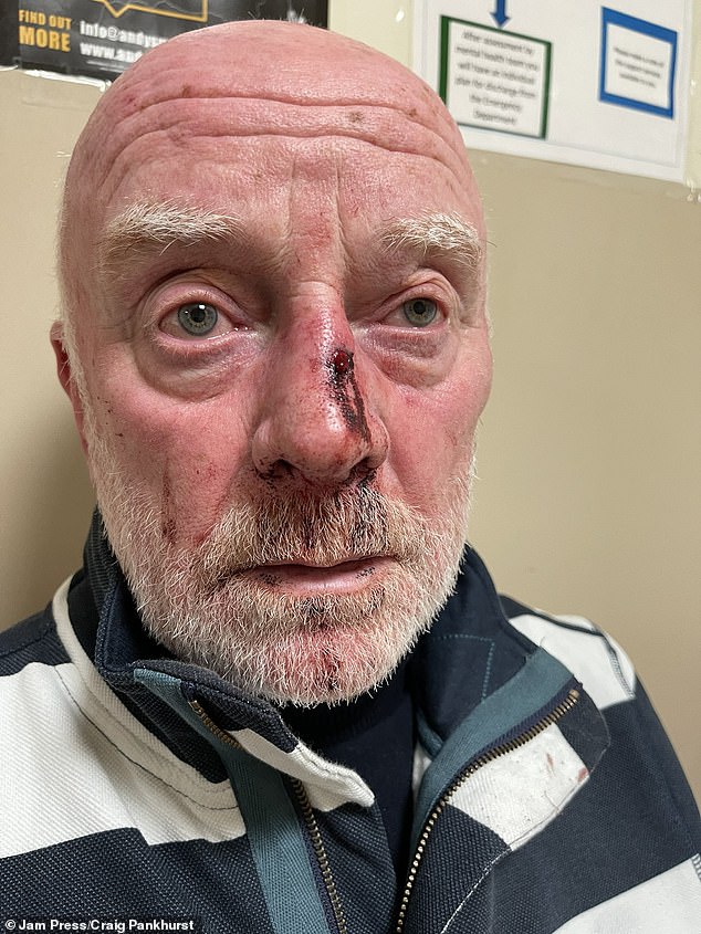 Pensioner Tottenham Hotspur fan Roy Pankhurst (pictured), 69, was beaten up by Sheffield United fans after their 1-0 FA Cup loss on a surprise trip to celebrate his upcoming 70th birthday